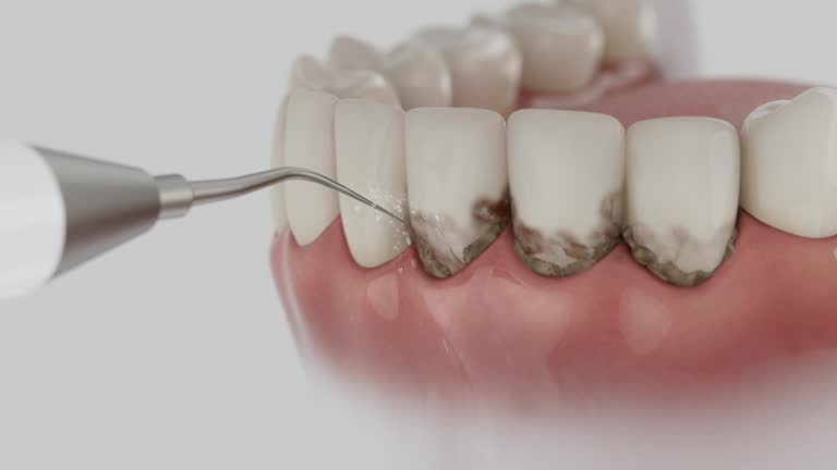 Reliable Dental Implants contractor in Immokalee, FL by Smile Center Dentistry